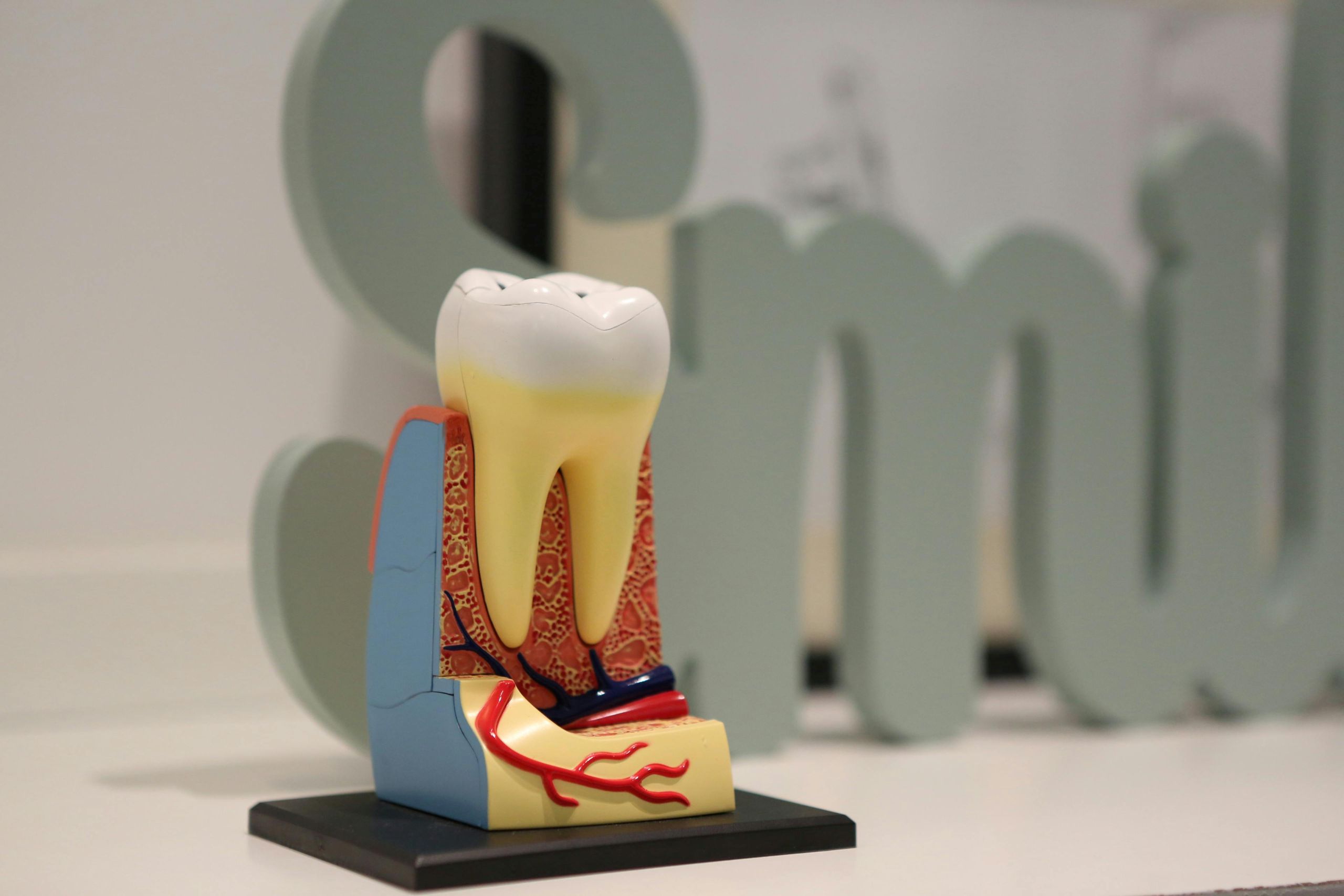 A model of a tooth showing internal structures, including details related to an apicoectomy, is displayed on a table, with a large decorative word Smile blurred in the background.