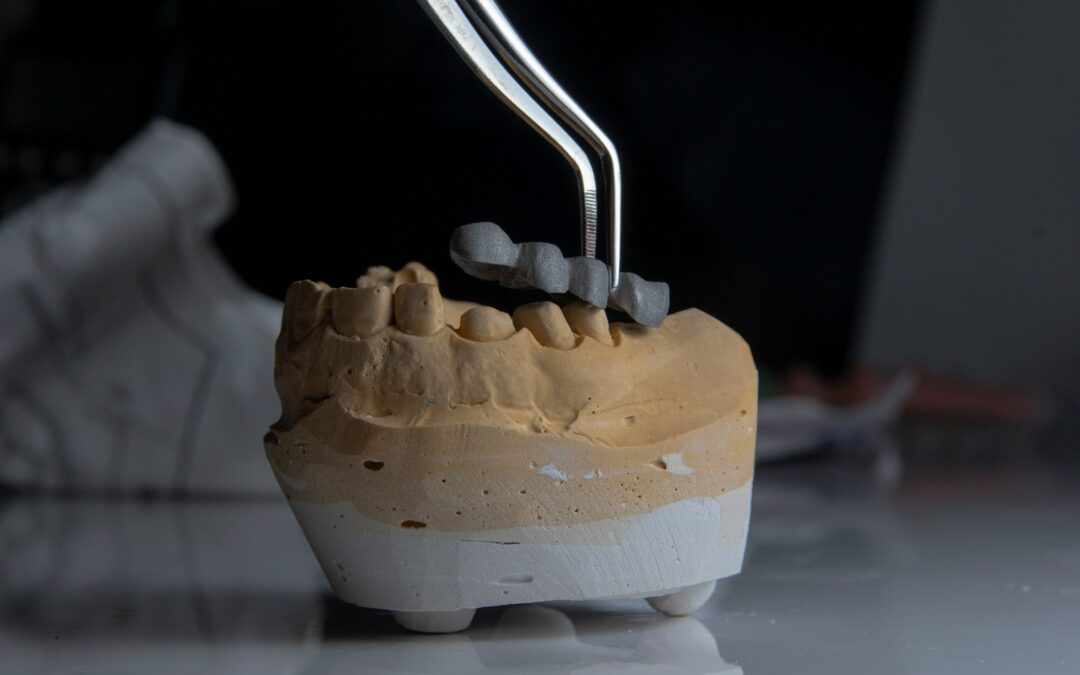 Root Canal Recovery Tips