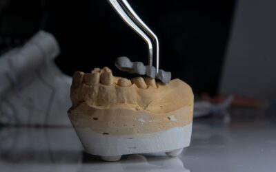 Root Canal Recovery Tips