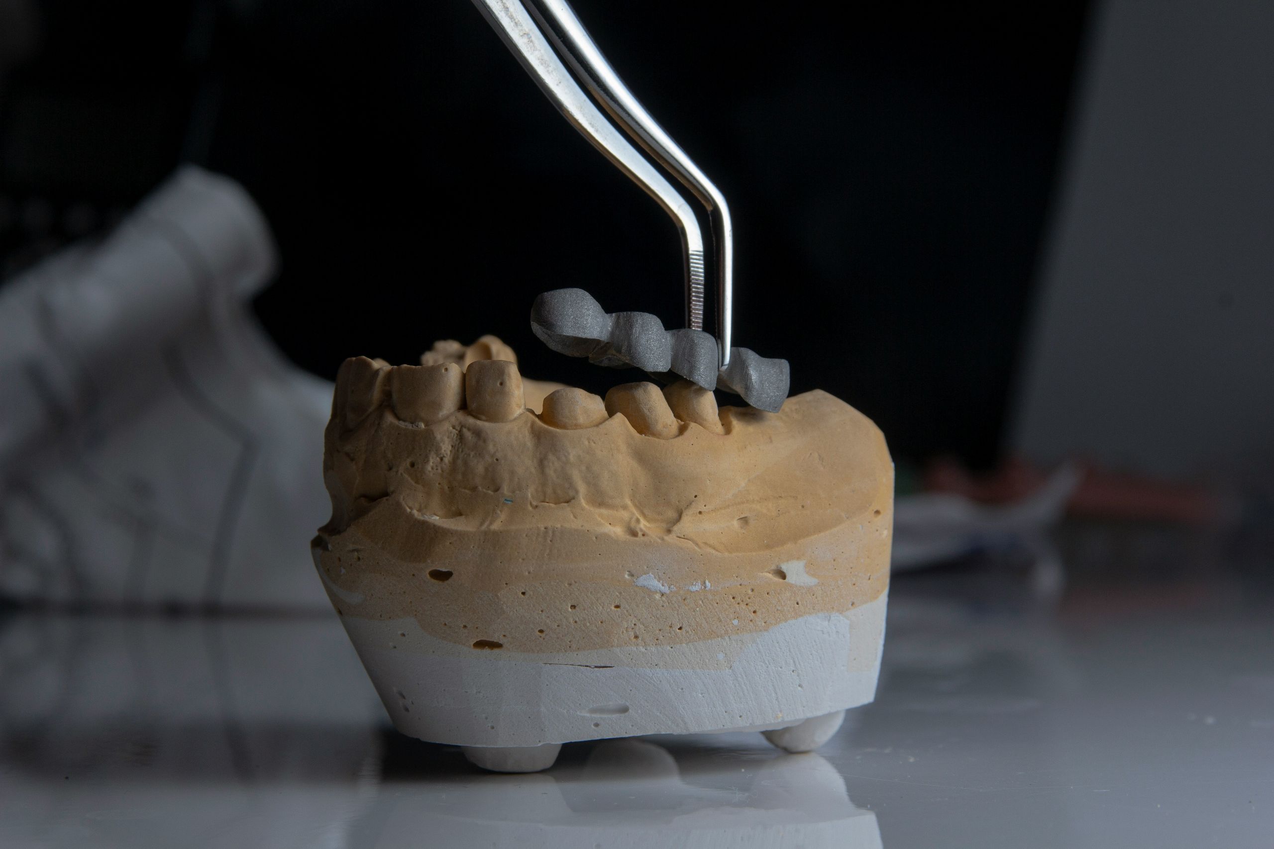 A dental tool holds metal dental crowns above a plaster model of human teeth—often used in root canal recovery—displayed on a reflective surface against a dark background.