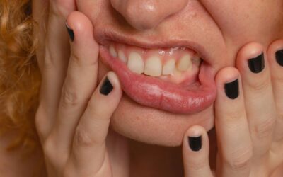 Traumatic Tooth Injury Treatment