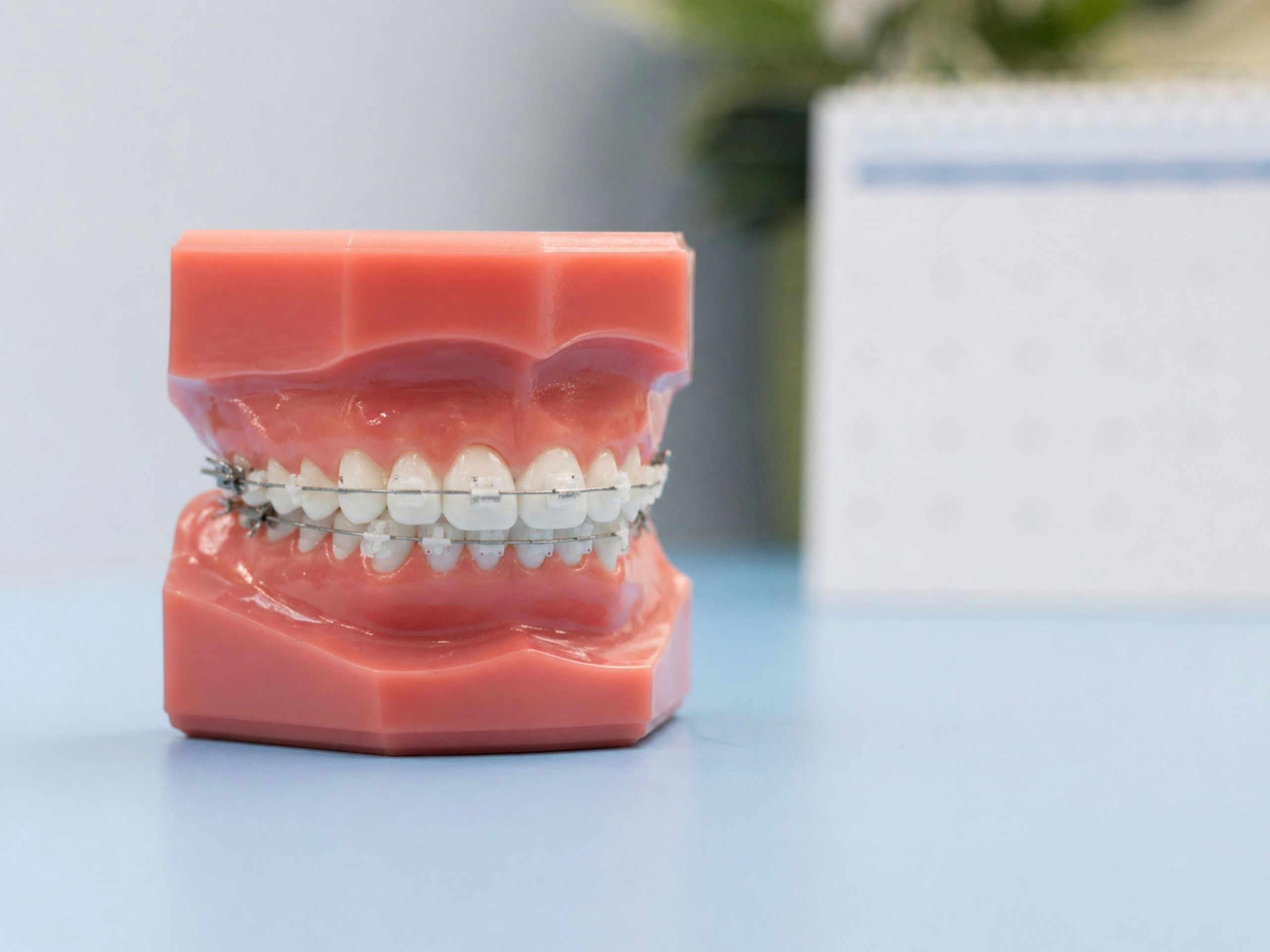 A dental model of human gums and teeth with clear braces is displayed on a blue surface, with a blurred calendar in the background.